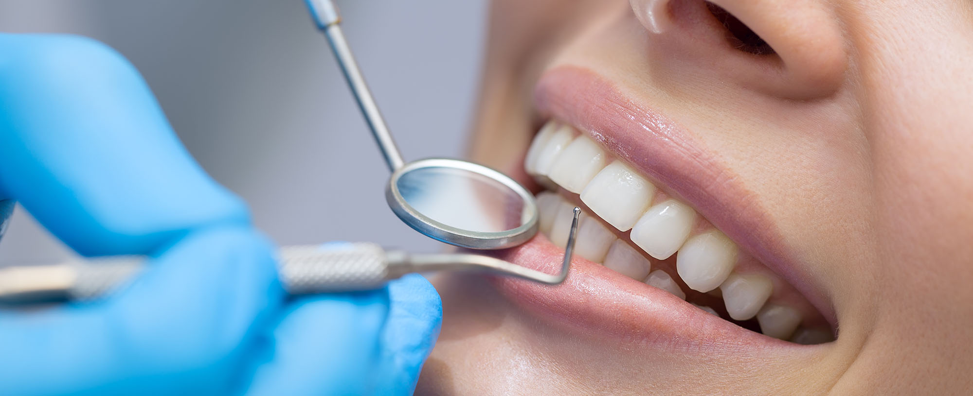Teeth Whitening Derby